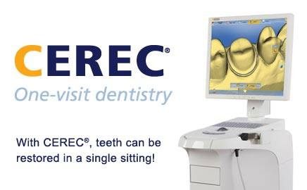 cerec_one-visit-crowns
